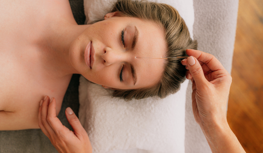 Acupuncture or Dry Needling: What’s the Difference?