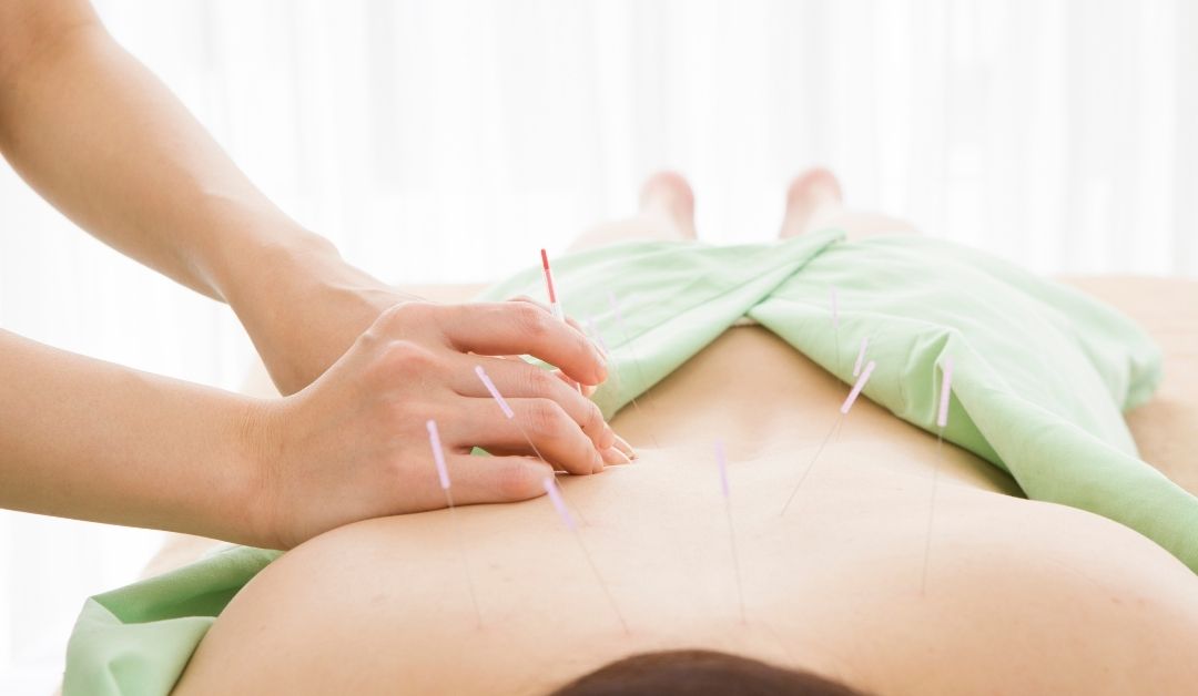 How Can Acupuncture Help Musculoskeletal Pain?